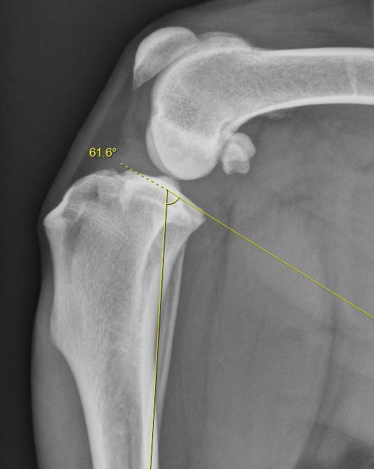 High-Resolution Digital Radiography