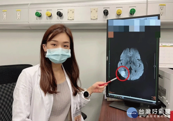 守家 l 改善急性腦中風失⽤症 靜脈雷射幫⼤忙
