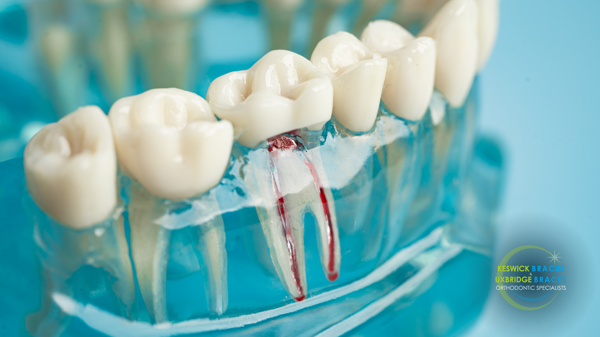 A close up of a model of a tooth with a root canal.