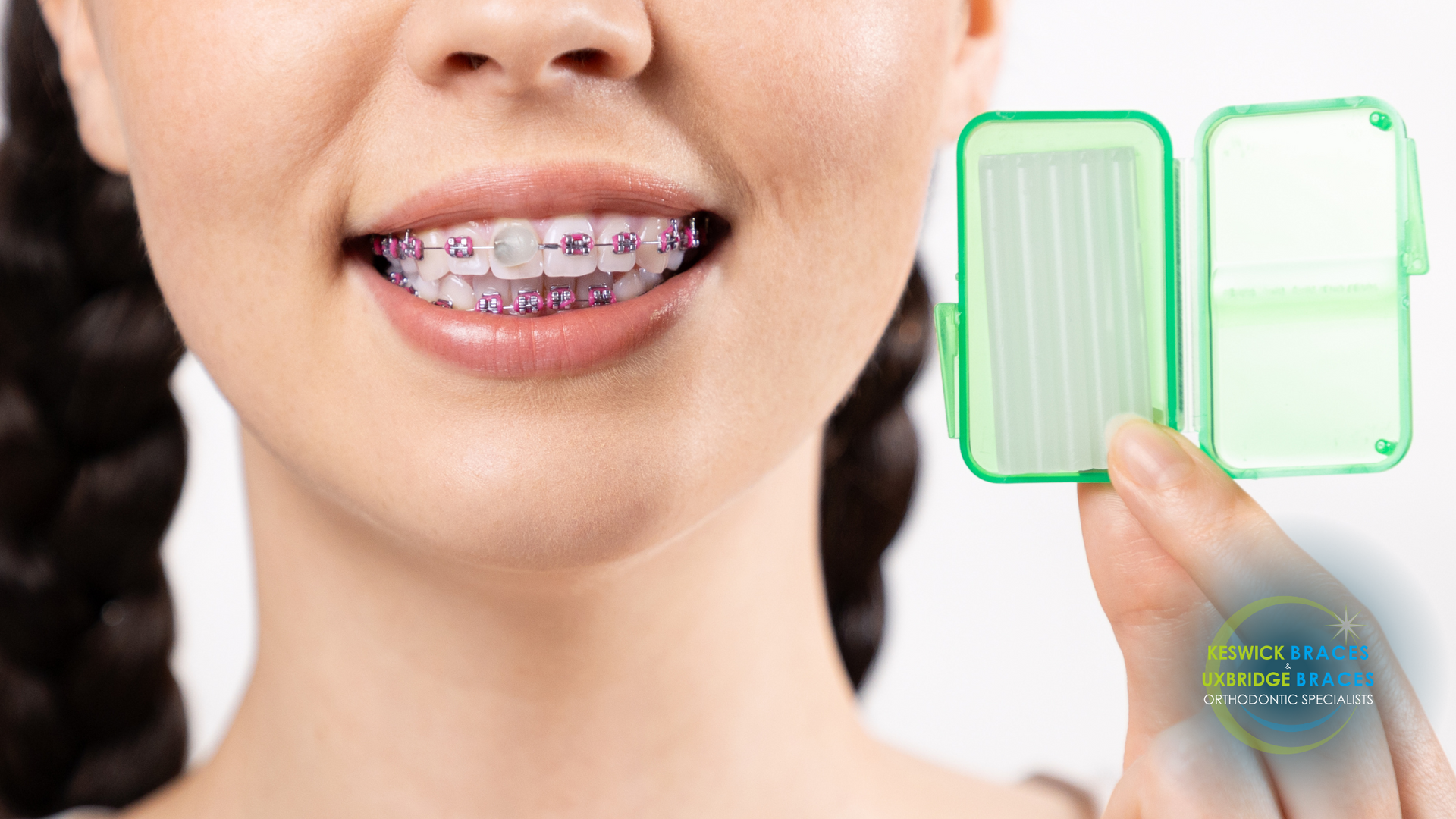 A woman with braces on her teeth is holding a green box.