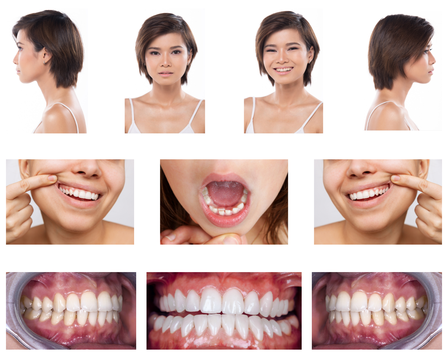 A collage of images of a woman 's face and teeth