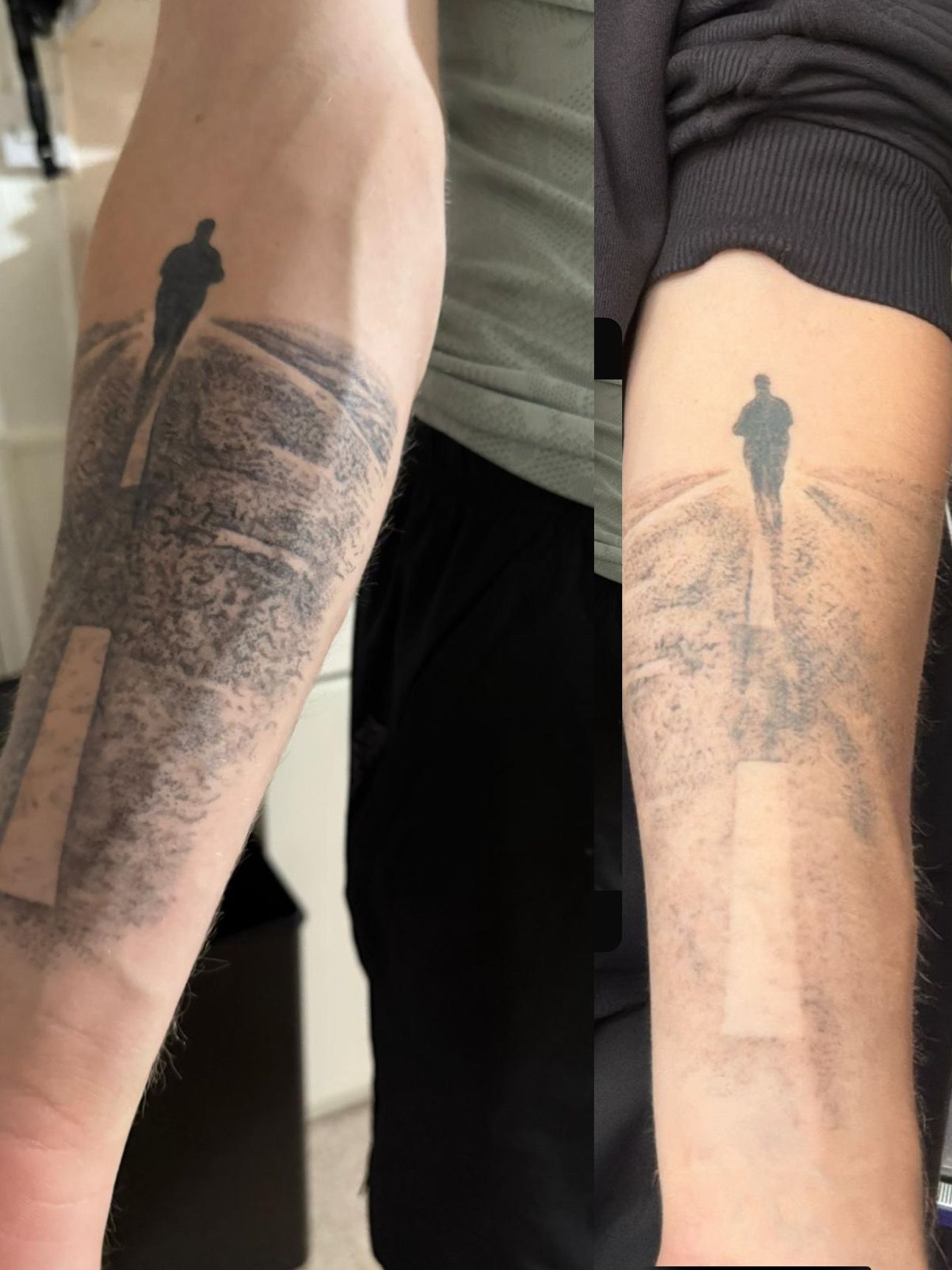 Side-by-side comparison of a tattoo on a forearm, showing fresh ink on the left and faded, healed ink on the right.