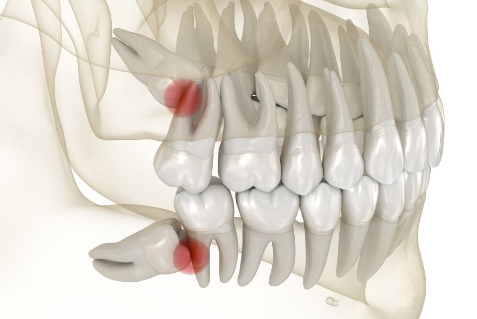 denti del giudizio