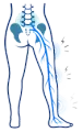 Lower body diagram showing sciatic nerve pain from lower back to leg, with blue nerve highlighted.