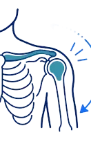 Shoulder joint anatomy with curved arrow indicating arm rotation or mobility exercise