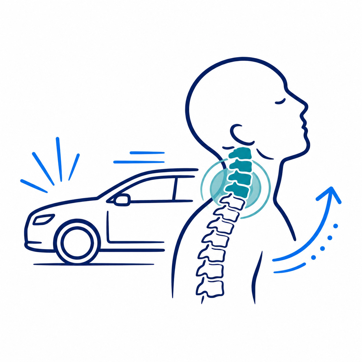 Car hitting neck, causing whiplash in spine illustration with blue motion lines