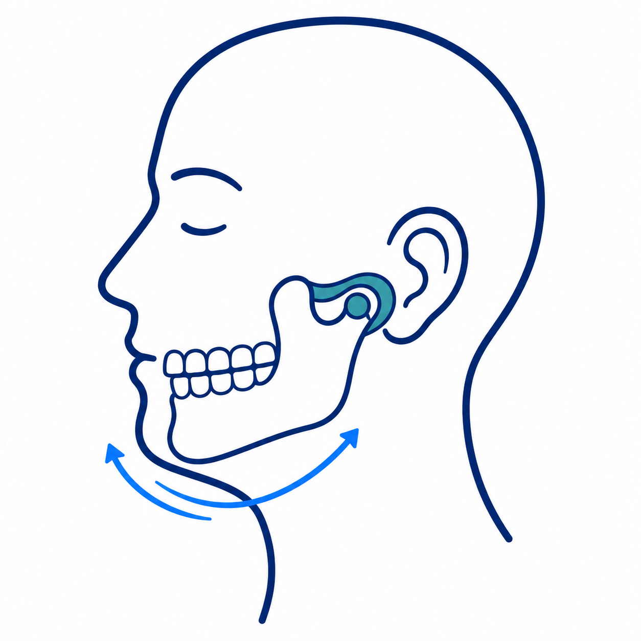 Side profile diagram of jaw movement with blue arrows highlighting the temporomandibular joint near the ear