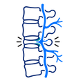 Blue spine diagram with a highlighted vertebra and nerves branching out on the right
