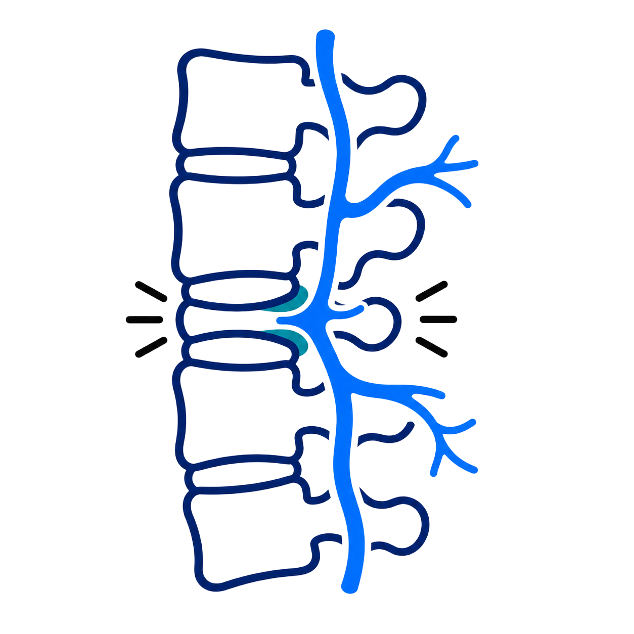 Blue spine diagram with a highlighted vertebra and nerves branching out on the right