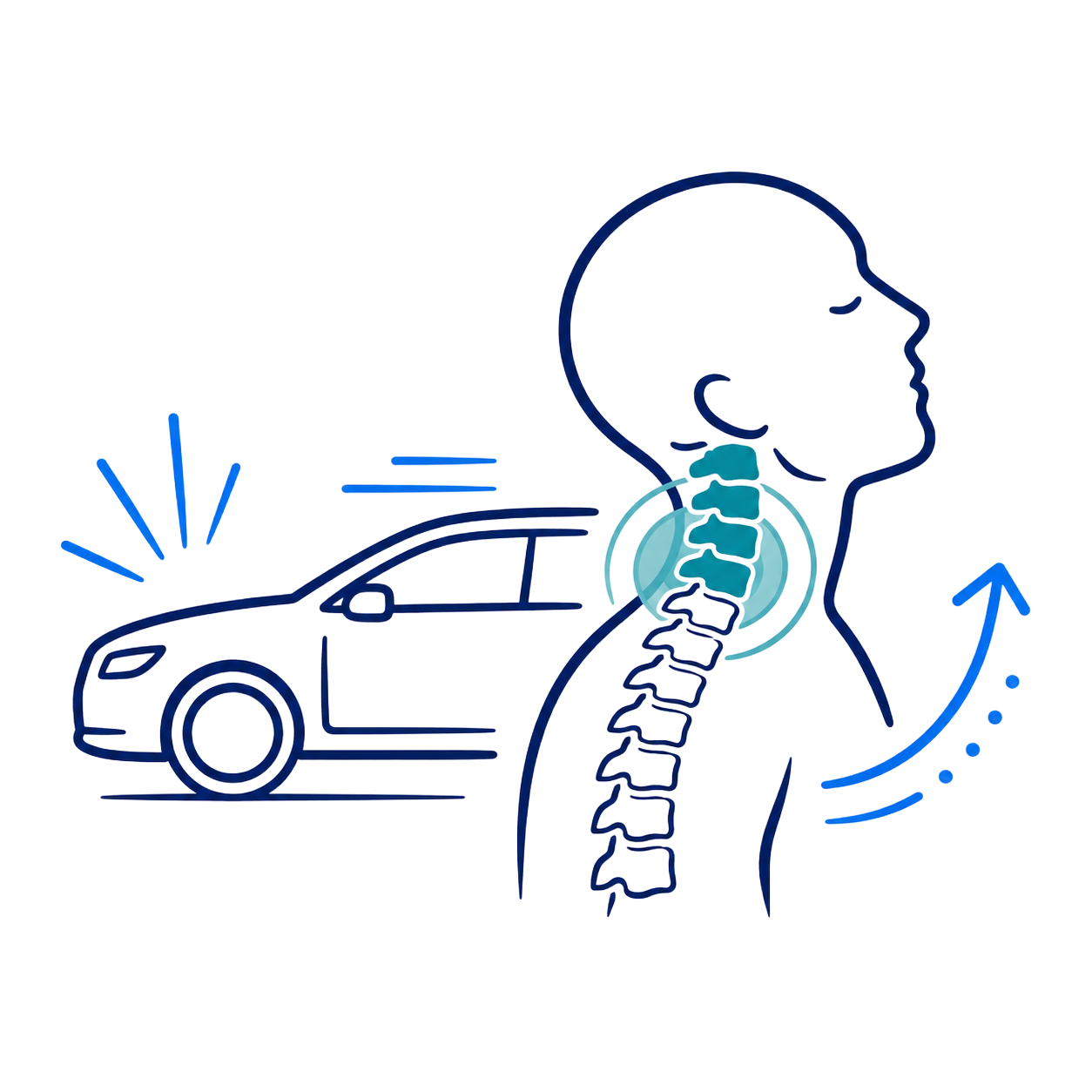 Car rear-end collision causing neck pain, with highlighted spine and whiplash motion arrows