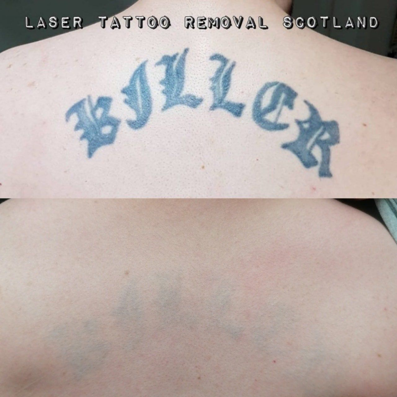 A woman has a tattoo on her back that says biller