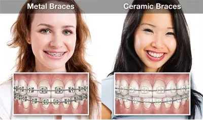 Orthodontists of adults — Jackson, MS — Eugene C. Brown, Jr., DDS, MS