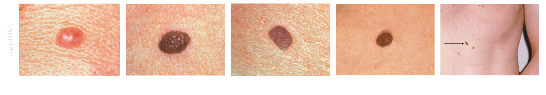 Home Page for Skin Dermatology - Skin Dermatology