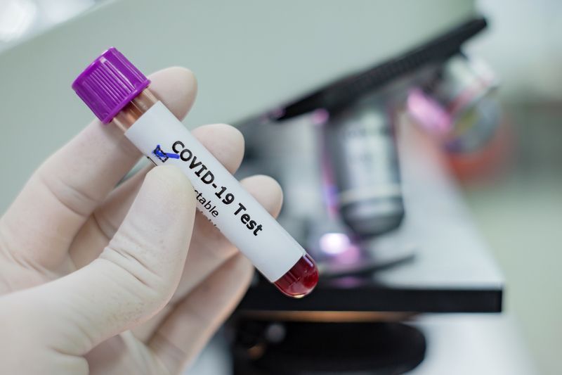 Gloved hand holding a blood sample vial labeled