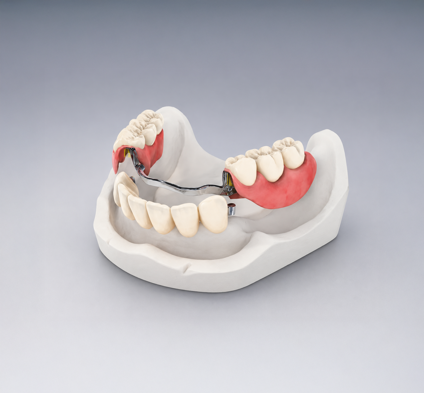 Dental model with partial dentures and white teeth on a gray background