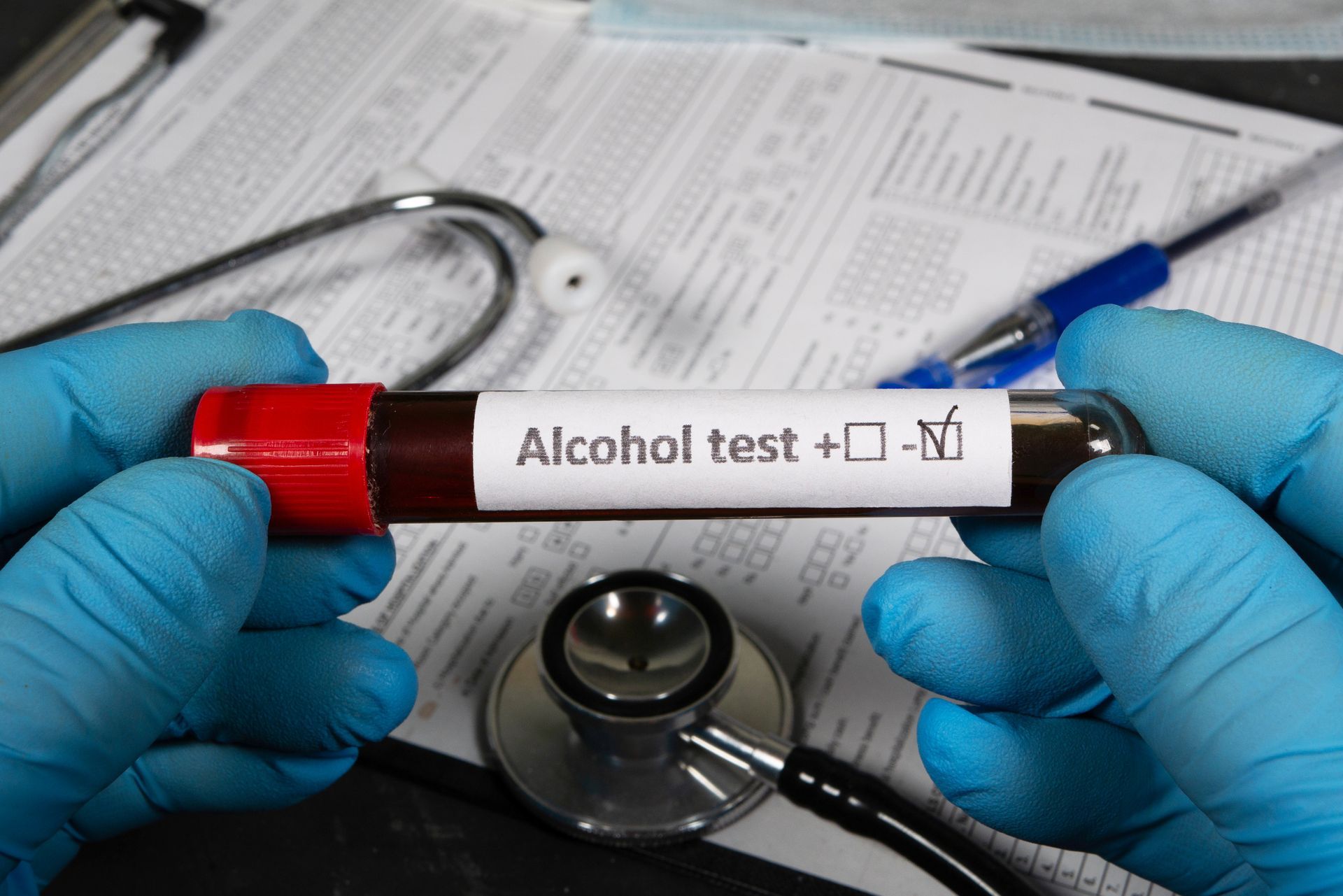 alcohol blood test