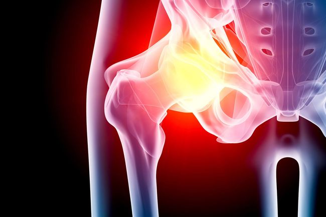 Hip In Pain - Prescott, AZ - Natural Back Pain Relief LLC Hip In Pain - Prescott, AZ - Natural Back Pain Relief LLC
