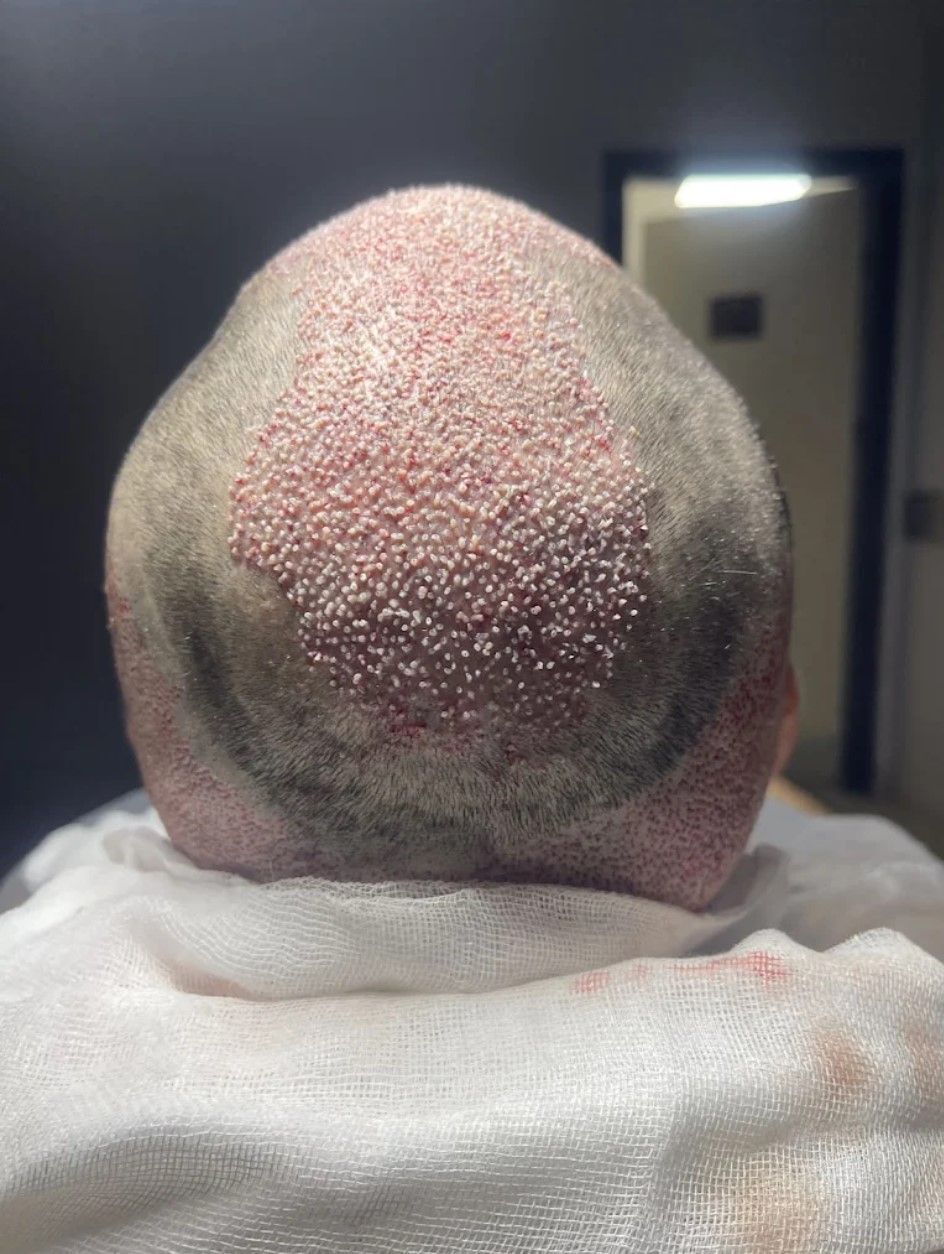 The back of a man 's head with a towel around it.