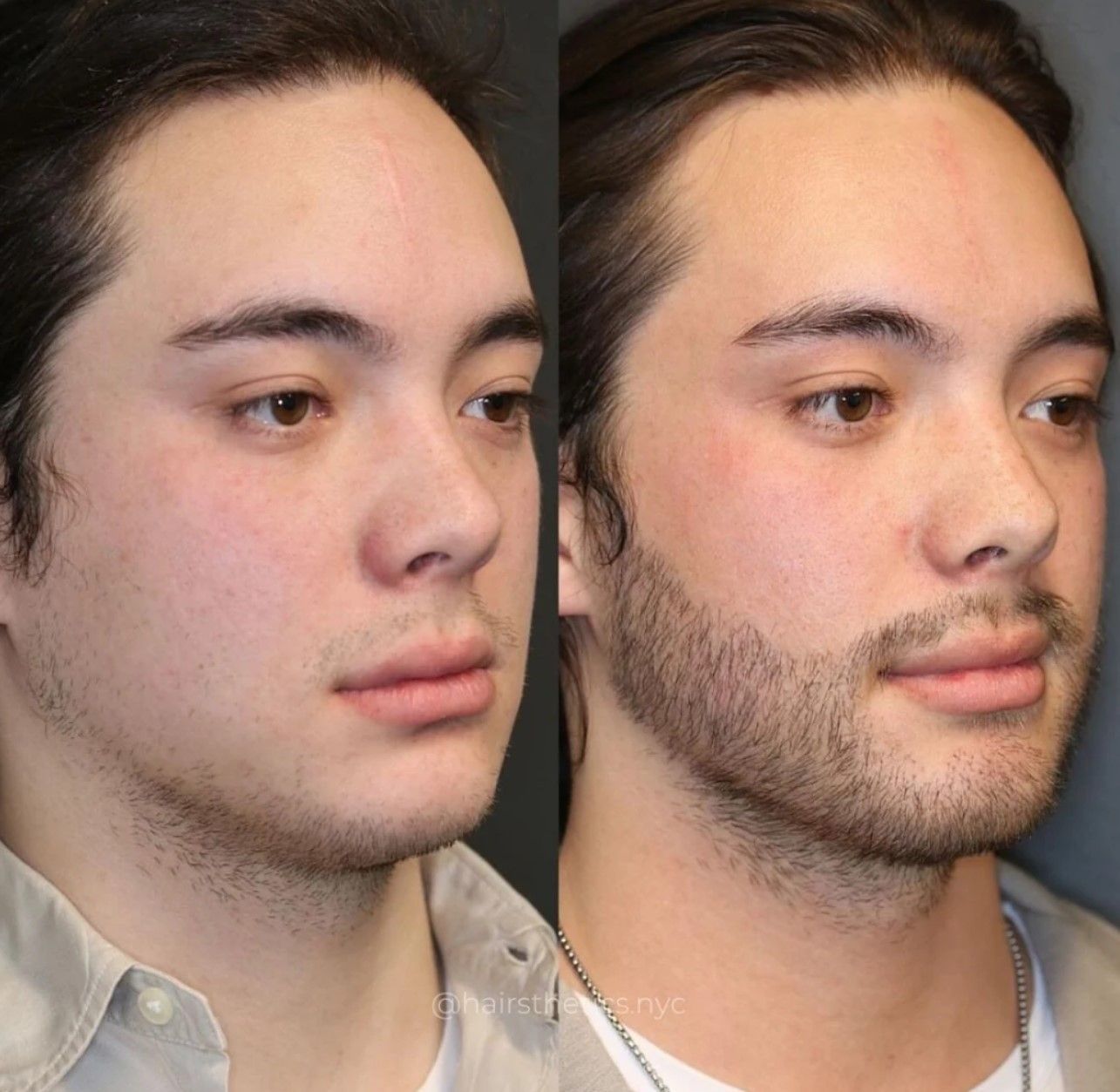 A before and after photo of a man with a beard