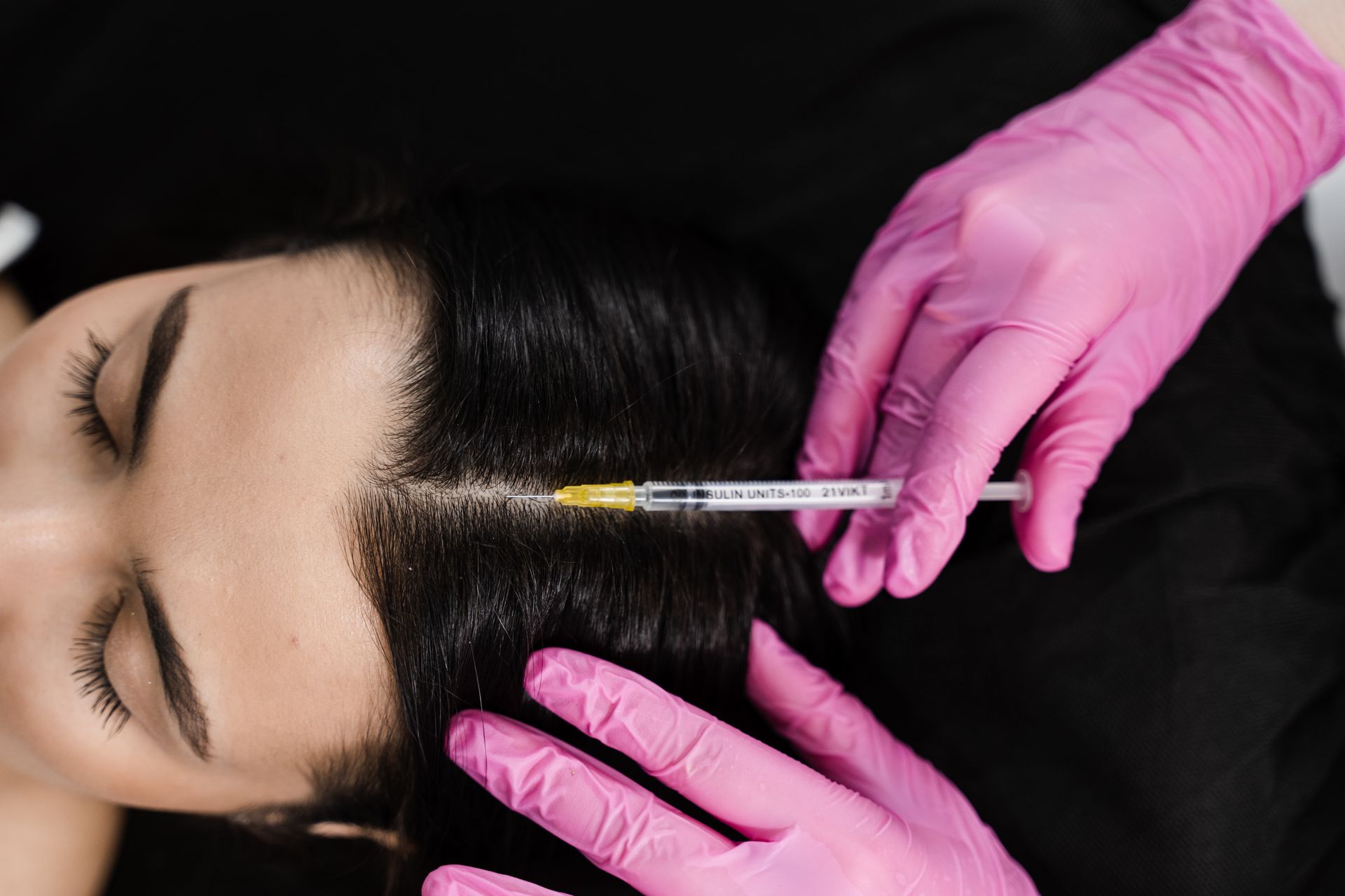 Gloved hands inject filler into a woman’s temple as she lies with eyes closed