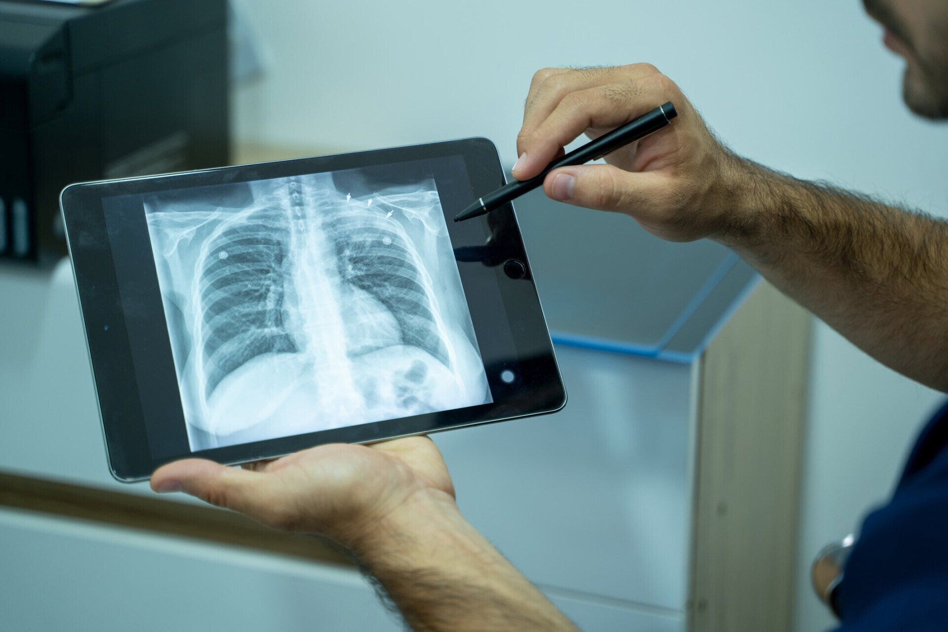 Hands holding a tablet displaying a chest X-ray while a pen points at the image.