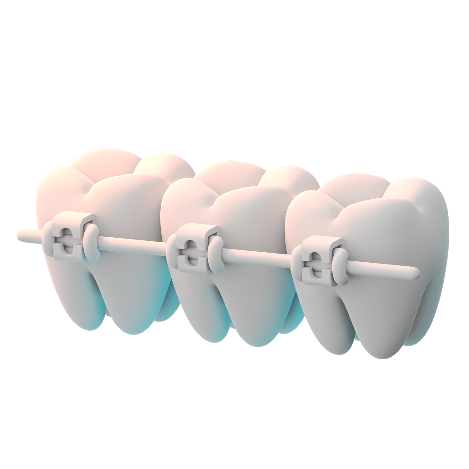 Una fila de dientes con aparatos ortopédicos sobre un fondo blanco.