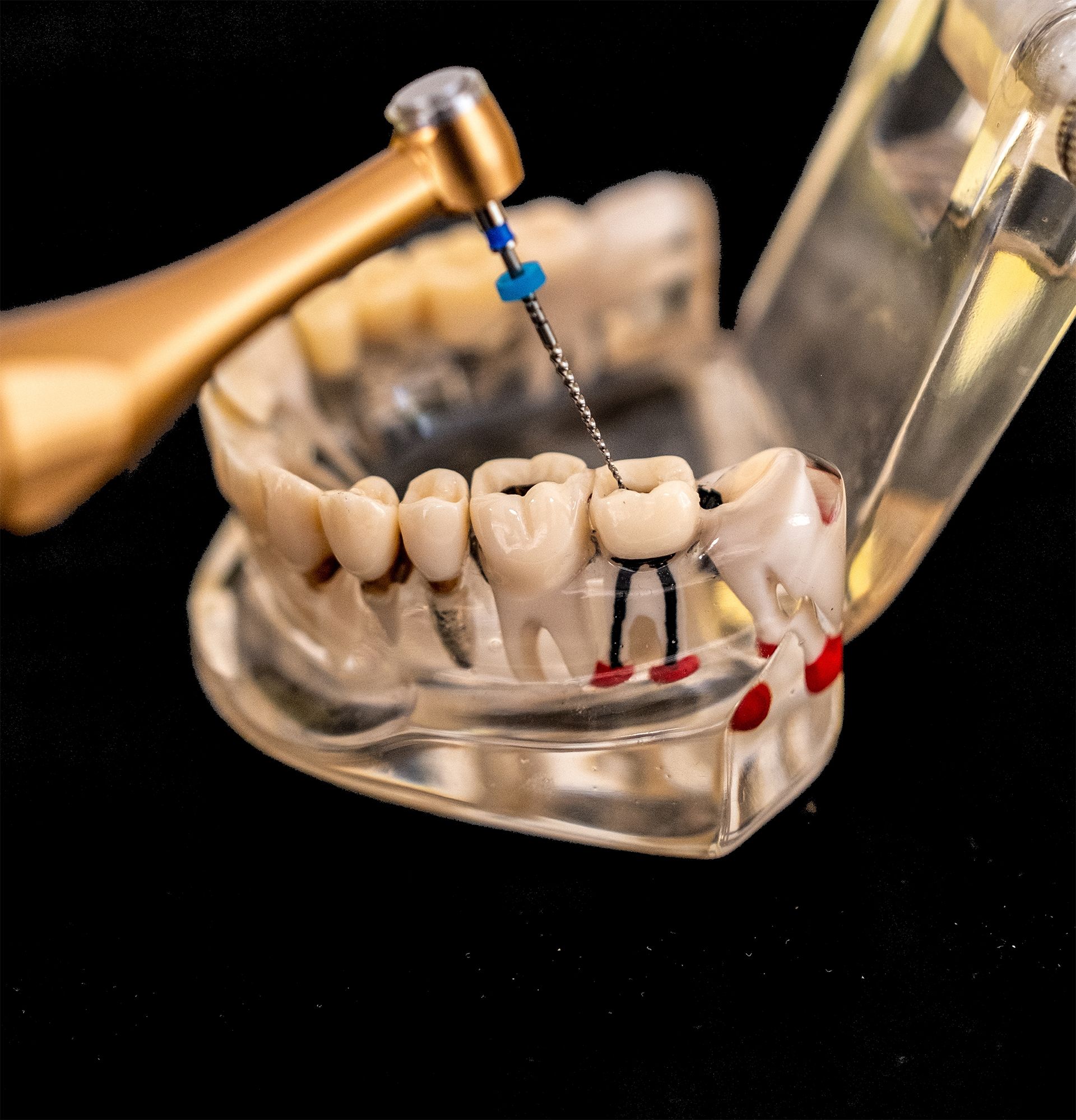 Un primer plano de un modelo dental con un taladro en él.
