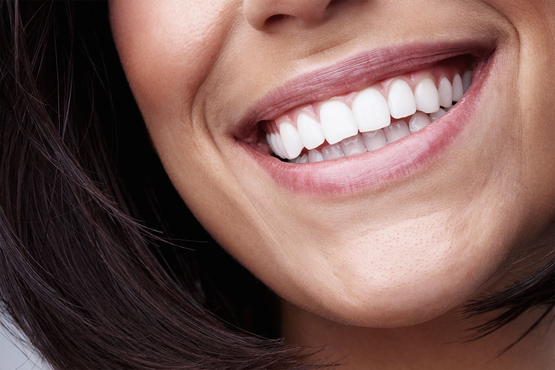 Un primer plano de la sonrisa de una mujer con dientes blancos.