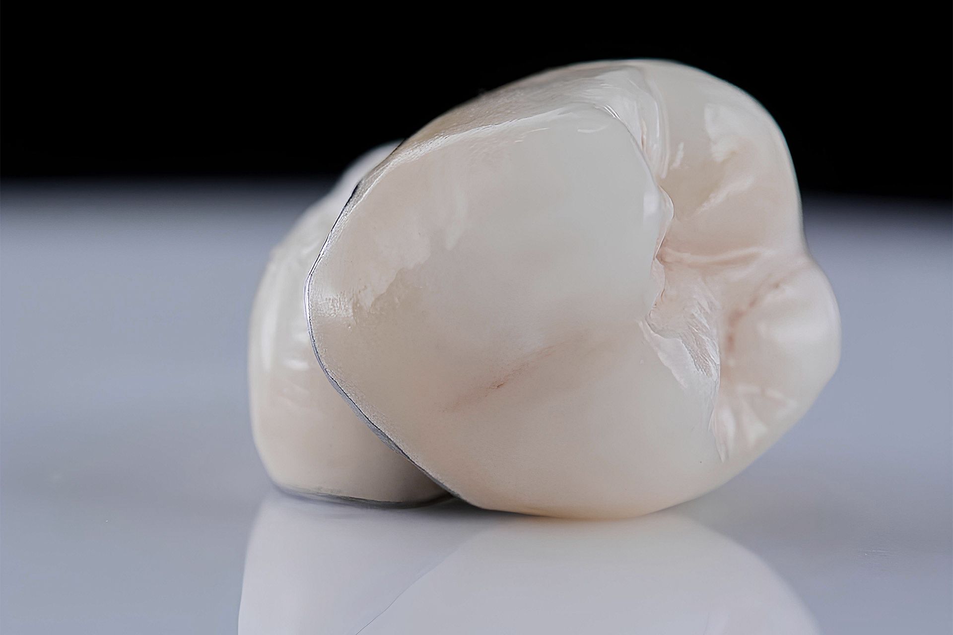 Un primer plano de una corona dental sobre una mesa.