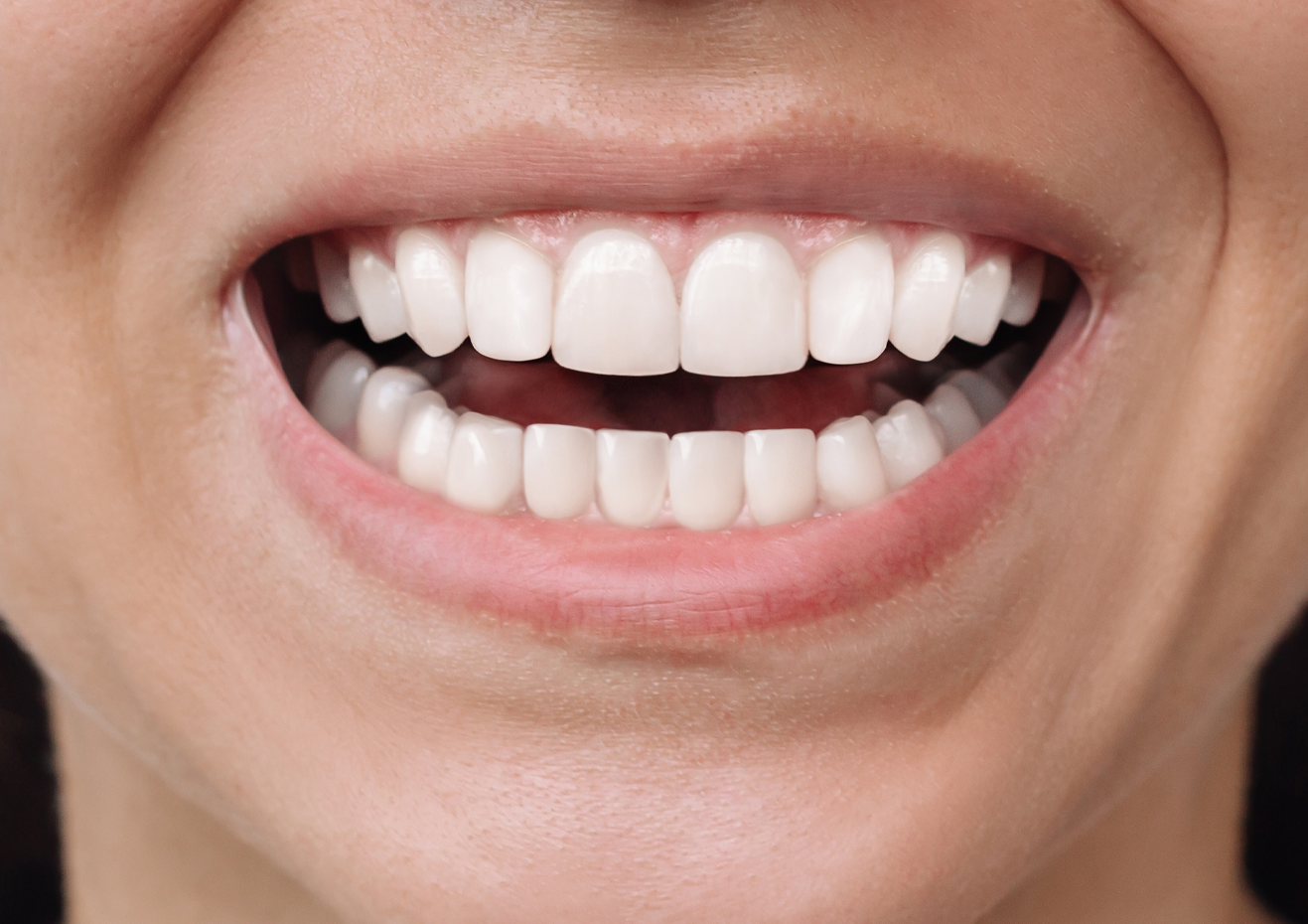 Un primer plano de la sonrisa de una mujer con dientes blancos.
