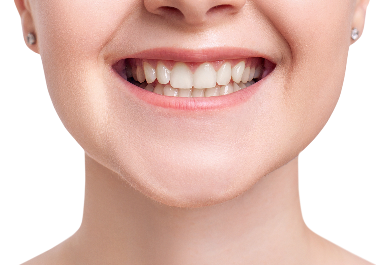 Un primer plano de la sonrisa de una mujer con dientes blancos.
