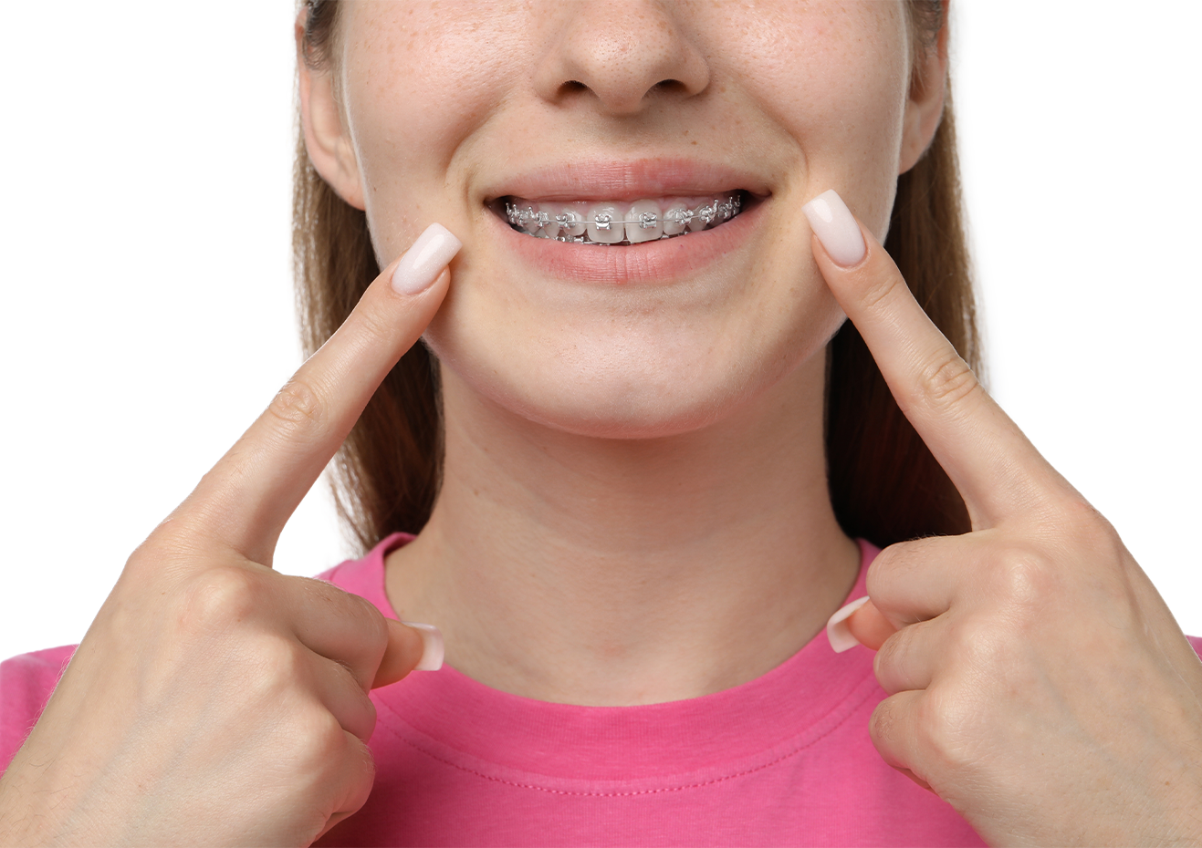 Un primer plano de una mujer con aparatos dentales.