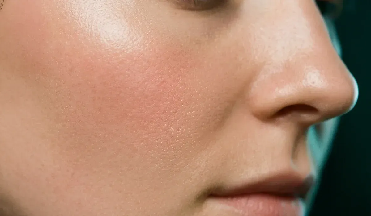 Red Carpet non-peel facial at The Head Spa Dallas