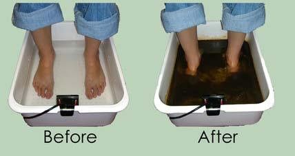 Foot Detox Treatment — Nicholson, PA — Optimal Whole Health & Nutrition Foot Detox Treatment — Nicholson, PA — Optimal Whole Health & Nutrition