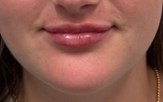 Close-up of a person’s lower face with neutral lips and light pink lipstick.