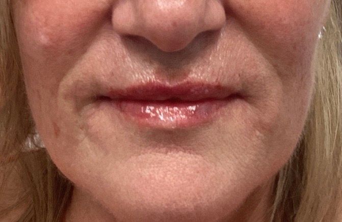 Close-up of a person’s mouth with glossy pink lips and blonde hair framing the face