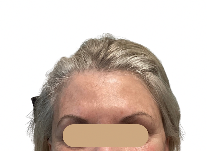 Close-up of a person’s forehead, eyes, and gray hair against a white background