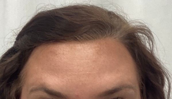 Close-up of a person’s forehead and eyes with dark brown hair against a light background