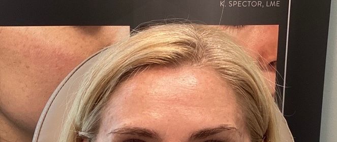 Close-up of a blonde person with a neutral expression, wearing a headband against a dark background.
