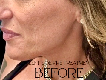 Close-up side profile of a woman's face with 