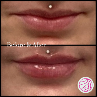 Before-and-after close-up of lips with a small silver piercing stud above the upper lip.