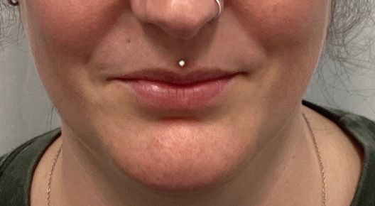 Close-up of a smiling mouth and chin with a small silver lip piercing.