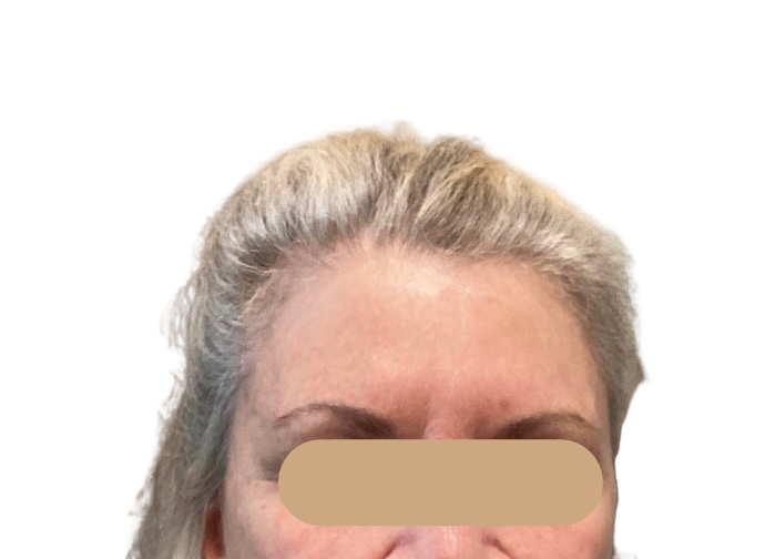 Close-up of a blonde person’s forehead and eyes, with a beige bar obscuring the nose and mouth