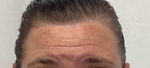 Close-up of a person’s forehead and eyes with hair pulled back against a plain background
