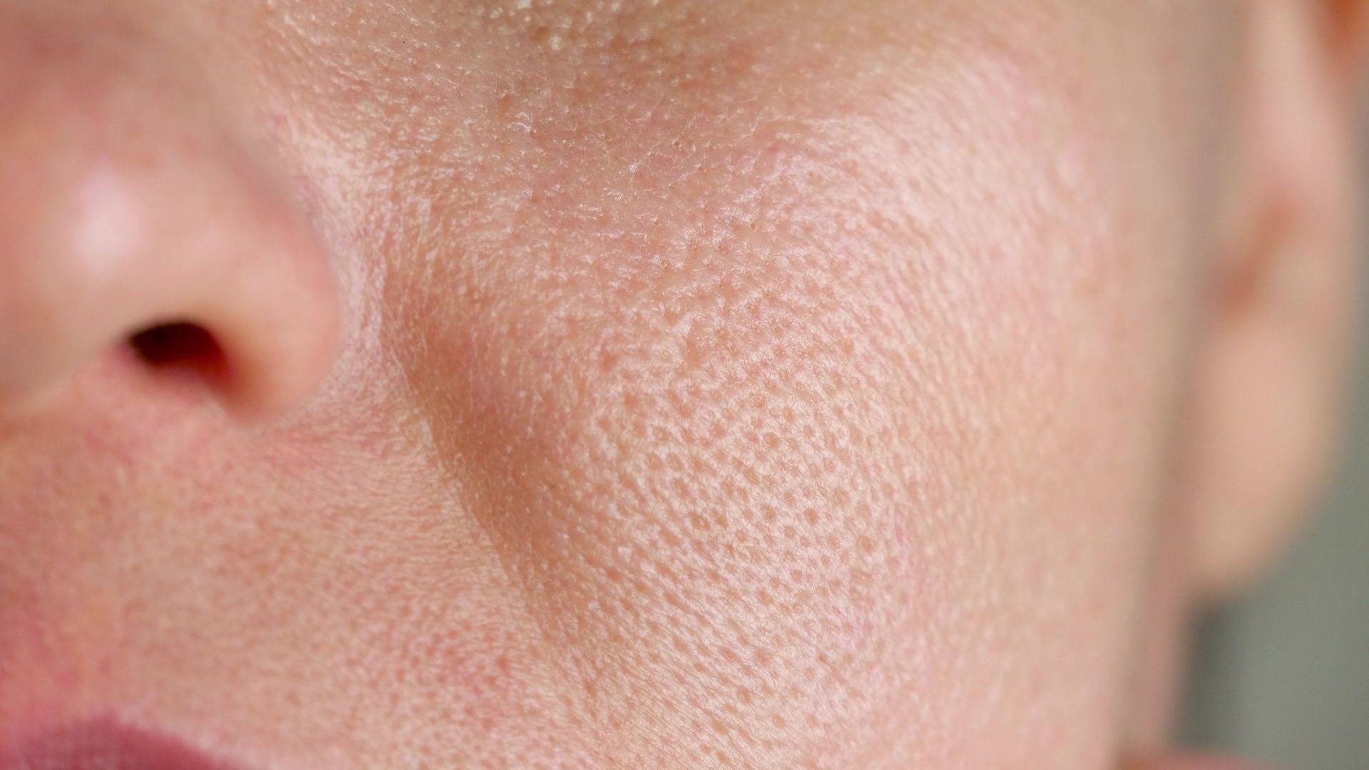 Close-up of a cheek and nose with visible skin texture and pores