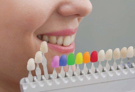 Smiling mouth beside a row of colorful dental shade tabs for teeth matching