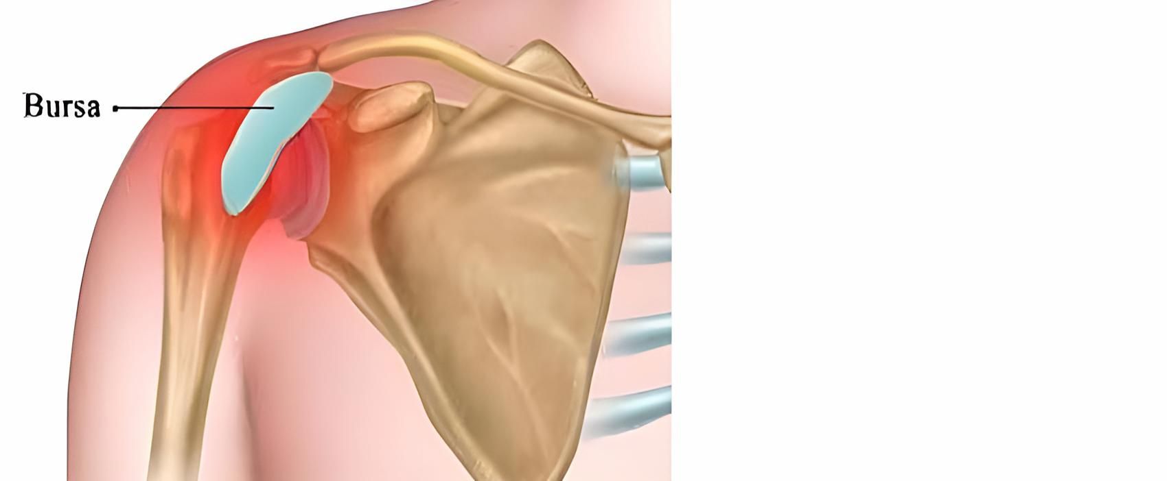 A Diagram of a Person 's Shoulder Showing the Bursa — Back Care Gold Coast in Nerang, QLD