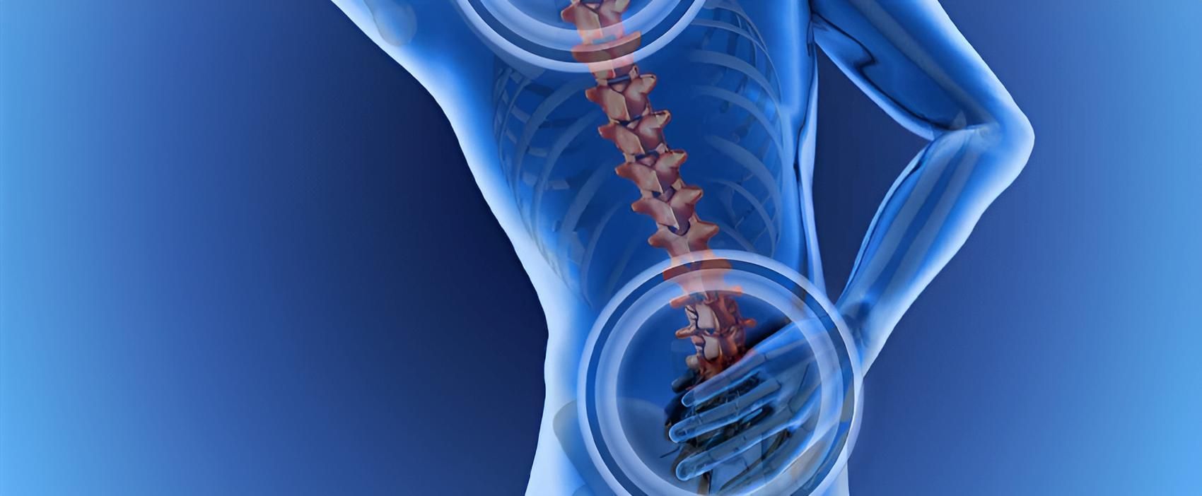 A X-ray of a Person's Back Showing the Spine and Ribs — Back Care Gold Coast in Nerang, QLD