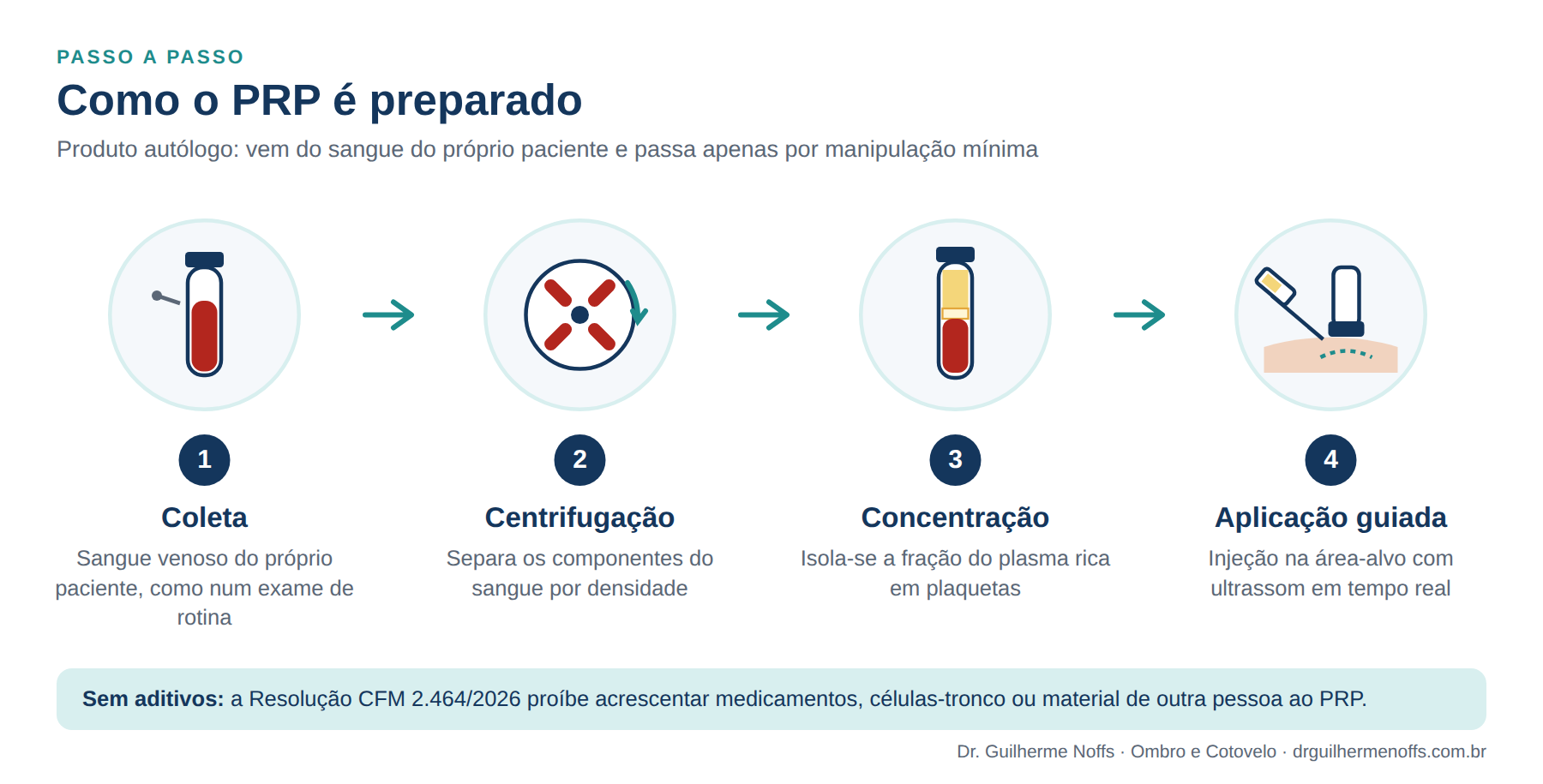 Figura 3. Preparo do PRP: coleta, centrifugação, concentração e aplicação guiada por imagem, sem acrescentar medicamentos ou células.
