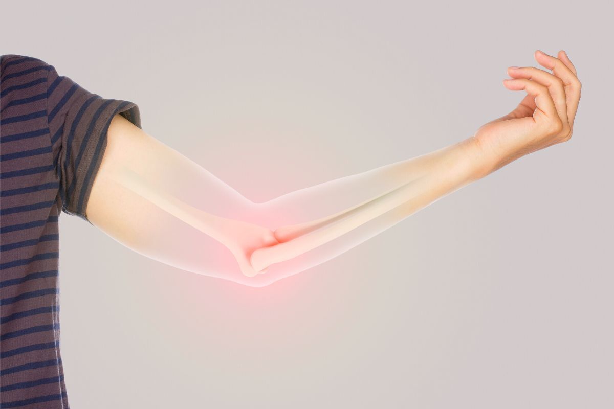 Cirurgia para Epicondilite Lateral São Paulo